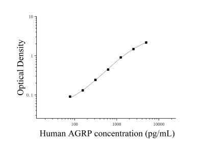 人刺鼠基因相關(guān)蛋白(AGRP)ELISA檢測試劑盒 [貨號(hào):JL45893]